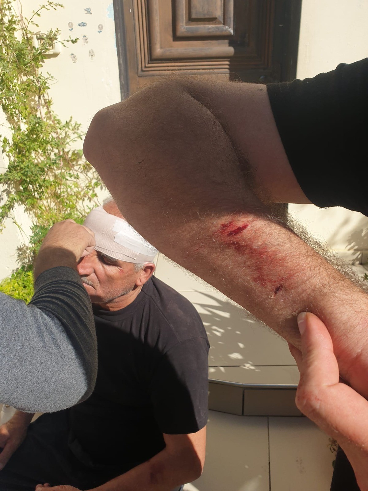 إصابتان في هجوم على قرية مادما جنوب نابلس.jpg