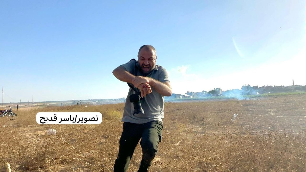 صابة الصحفي أشرف أبو عمرة بيده أثناء تغطيته للمظاهرات شرق مدينة خانيونس.jpg