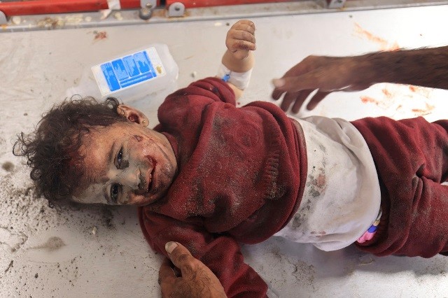 طفلة تتلقى العلاج في مستشفى ناصر في خان يونس بعد إصابتها في القصف الإسرائيلي المتواصل على قطاع غزة (تصوير-أ ف ب).jpg