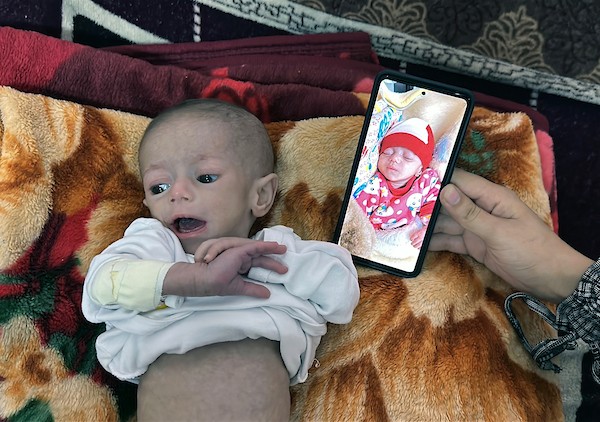 الرضيعة الفلسطينية سُوار عاشور (5).jpg