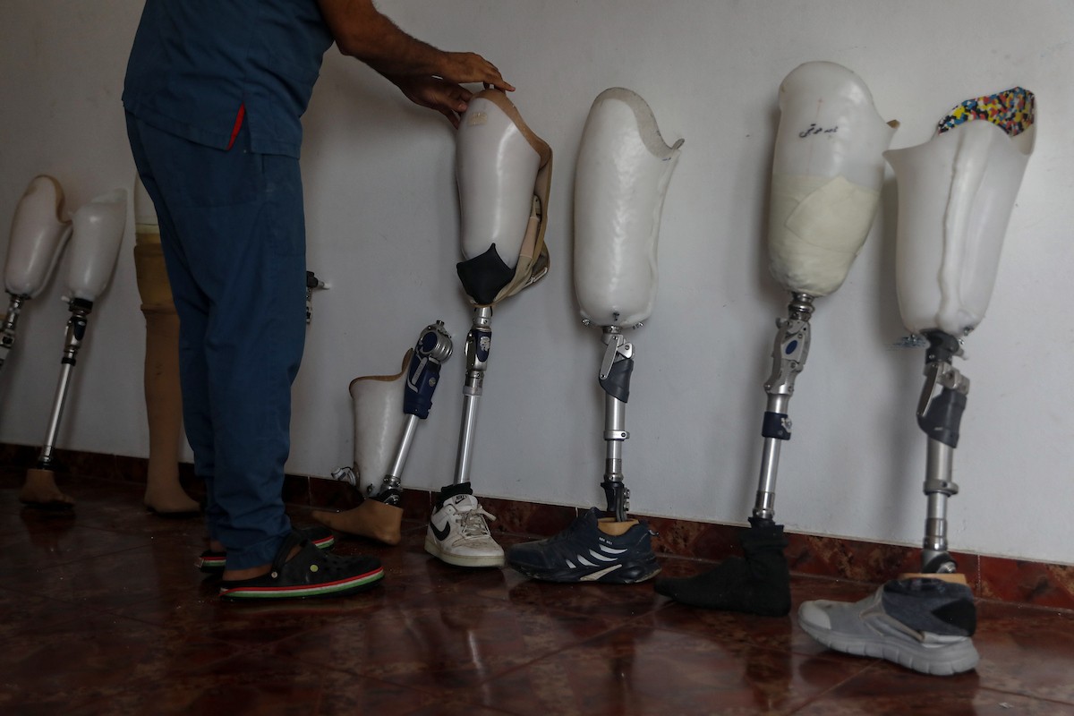 فلسطينيون، بينهم أطفال، يتلقون جلسات تأهيل باستخدام أطراف صناعية في مستشفى حمد للتأهيل بمنطقة (22).jpg