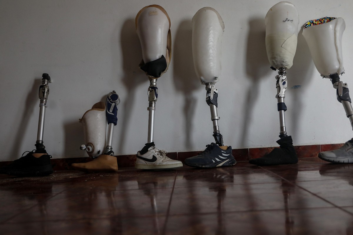 فلسطينيون، بينهم أطفال، يتلقون جلسات تأهيل باستخدام أطراف صناعية في مستشفى حمد للتأهيل بمنطقة (24).jpg