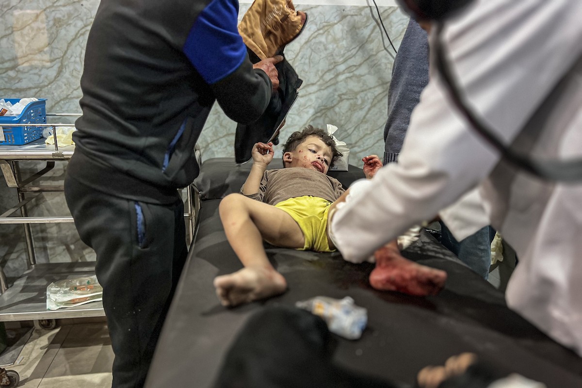 يتم نقل الجرحى الفلسطينيين بمن فيهم الأطفال إلى المستشفيات لتلقي العلاج بعد أن شن جيش الاحتلال الإسرائيلي هجمات على عدة مناطق في قطاع غزة على الرغم من وقف إطلاق النار، مستهدفًا مبنى تابعًا لعائلة أبو شاويش في مخيم ا (3).jpg