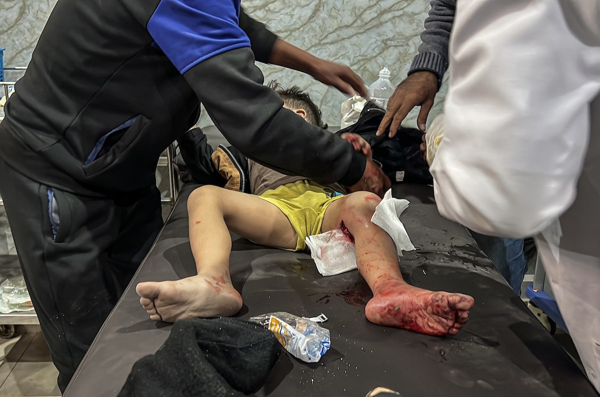 يتم نقل الجرحى الفلسطينيين بمن فيهم الأطفال إلى المستشفيات لتلقي العلاج بعد أن شن جيش الاحتلال الإسرائيلي هجمات على عدة مناطق في قطاع غزة على الرغم من وقف إطلاق النار، مستهدفًا مبنى تابعًا لعائلة أبو شاويش في مخيم ا.jpg