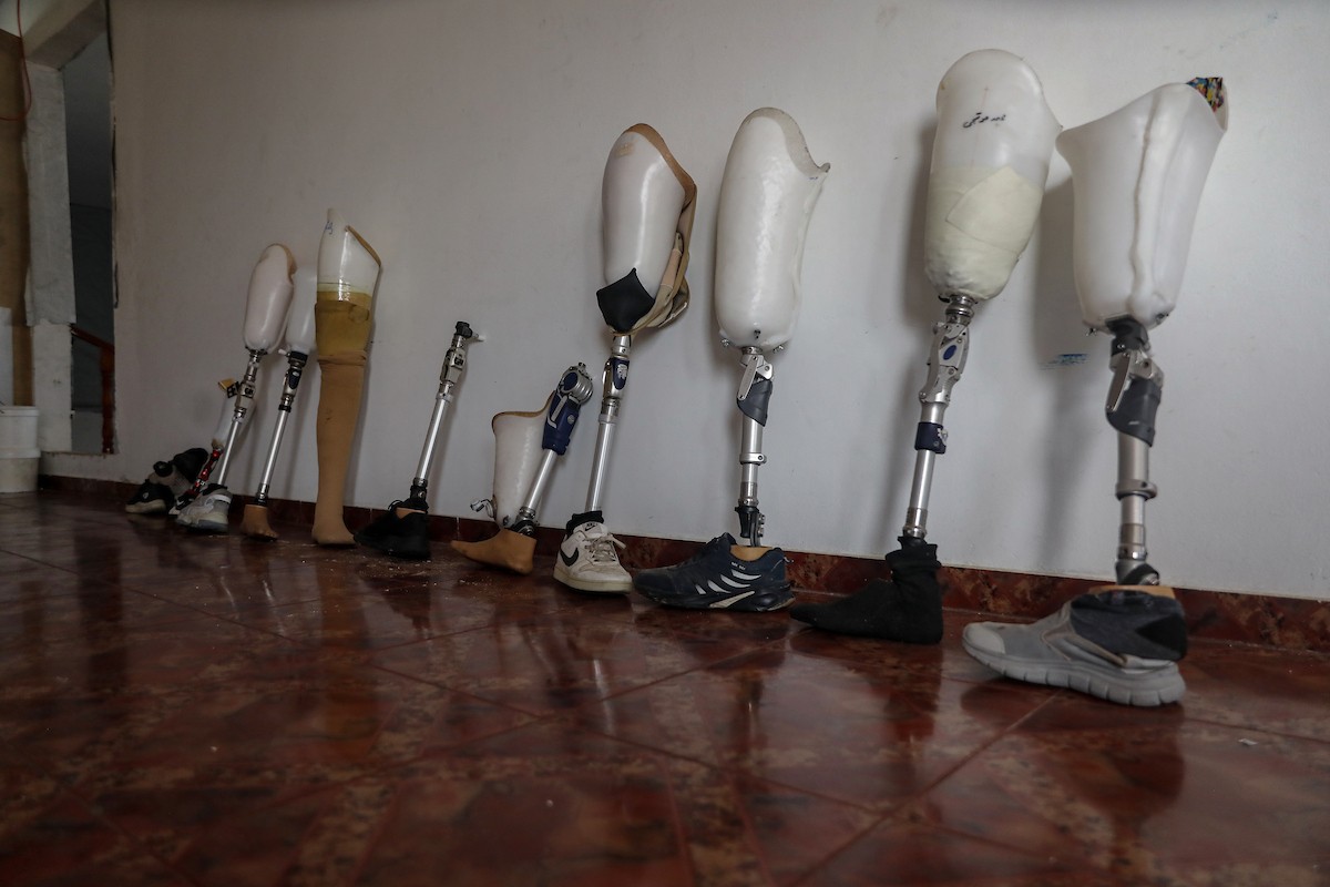 فلسطينيون، بينهم أطفال، يتلقون جلسات تأهيل باستخدام أطراف صناعية في مستشفى حمد للتأهيل بمنطقة (23).jpg