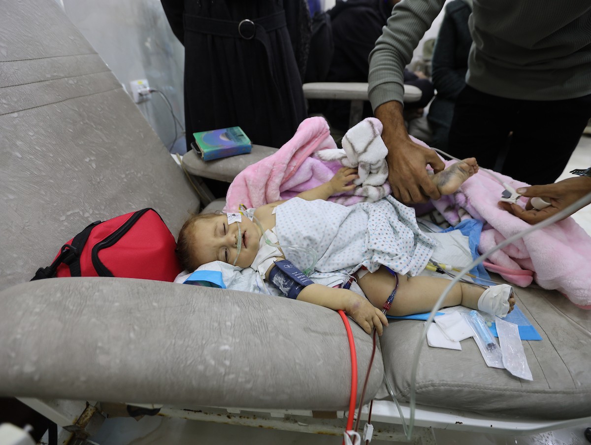 تتلقى الطفلة الفلسطينية سما أبو عجوة، المصابة بمرض نادر، رعاية طبية محدودة في مستشفى الشفاء بمدينة غزة، 19 ديسمبر/كانون الأول 2025. تصوير: عمر أشتوي