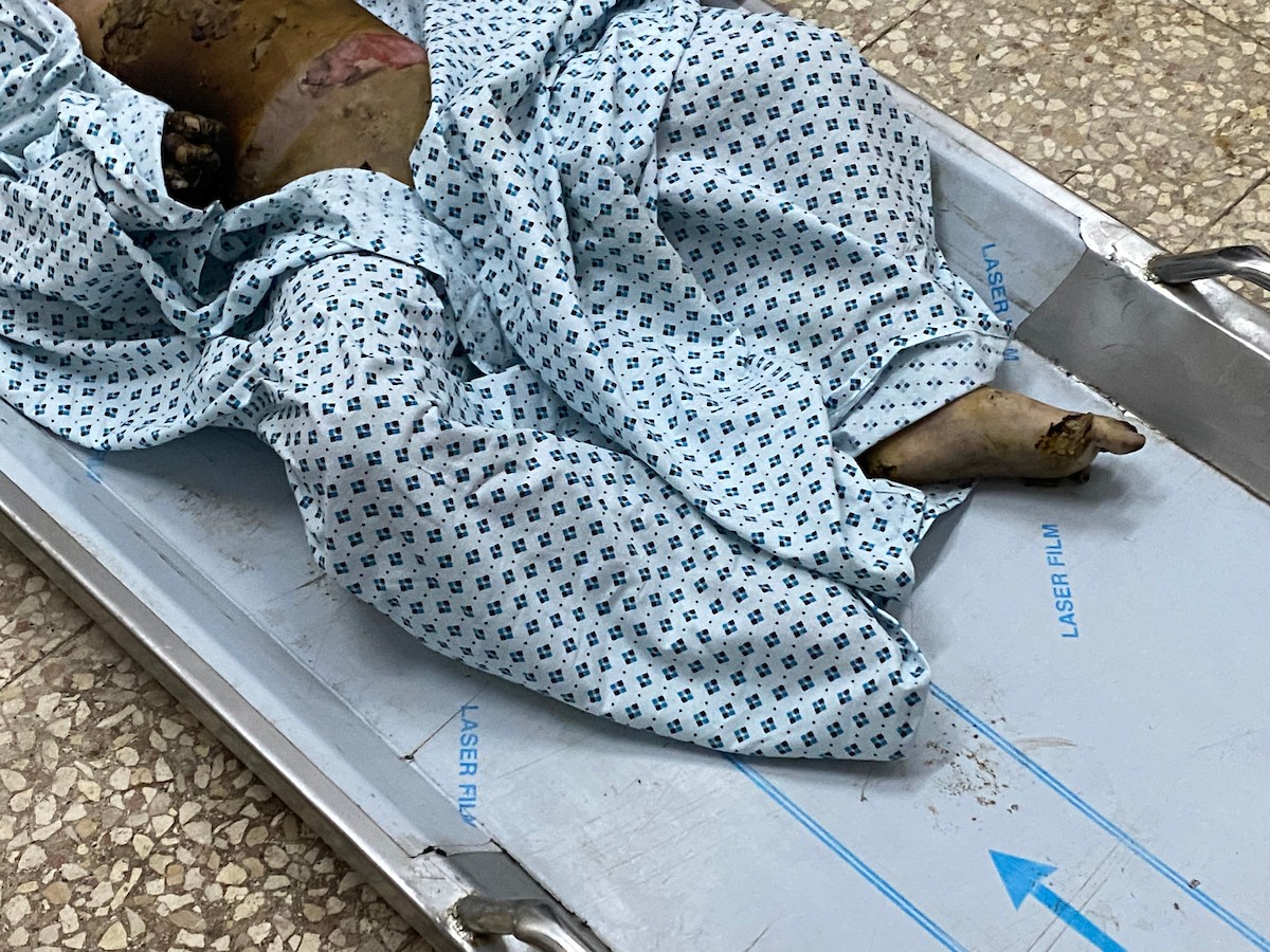 وصل جثمان طفل متوفى إلى مستشفى شهداء الأقصى إثر انفجار جسم مشبوه من مخلفات الاحتلال الإسرائيلي التي خلّفتها الحرب في مخيم النصيرات للاجئين وسط قطاع غزة. ١٨ ديسمبر ٢٠٢٥. تصوير: أحمد إبراهيم