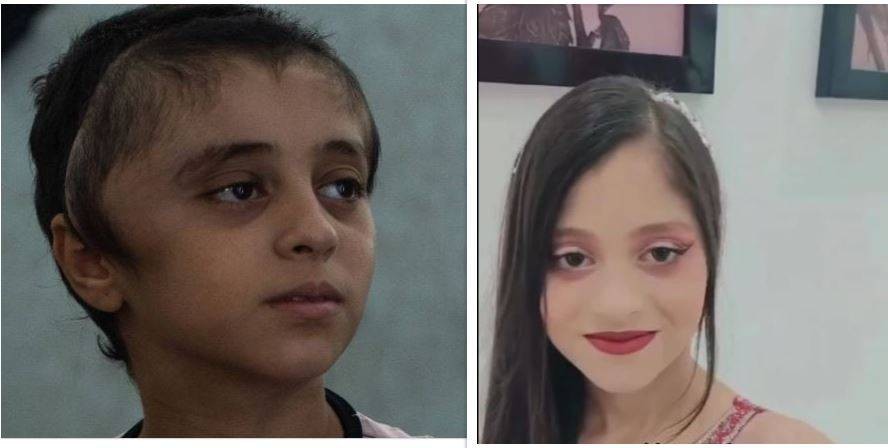 على اليمين صورة لمريم إبراهيم قبل الإصابة في الحرب... ويساراً صورة لها بعد الإصابة (وسائل إعلام محلية - إ.ب.أ).jpeg