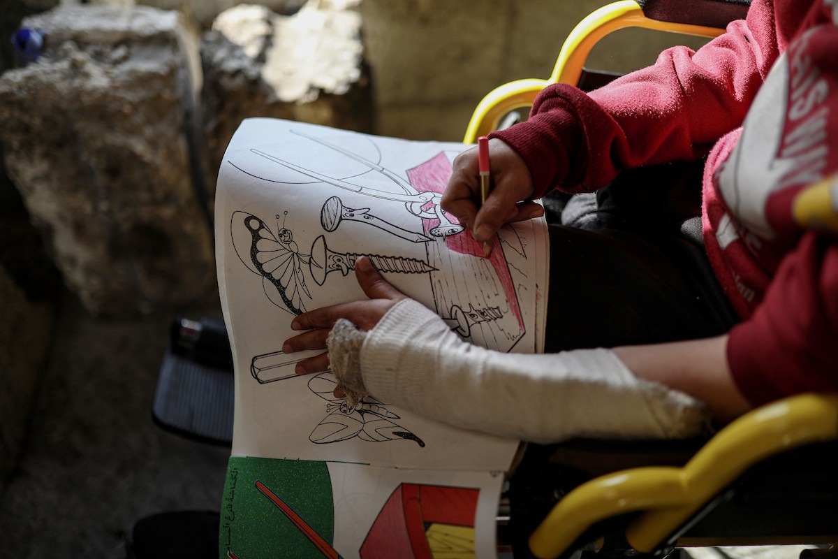 الطفل الفلسطيني محمد المبيض، البالغ من العمر ١٢ عامًا، والذي فقد ساقه في هجوم إسرائيلي على حي الزيتون بغزة (4).jpg