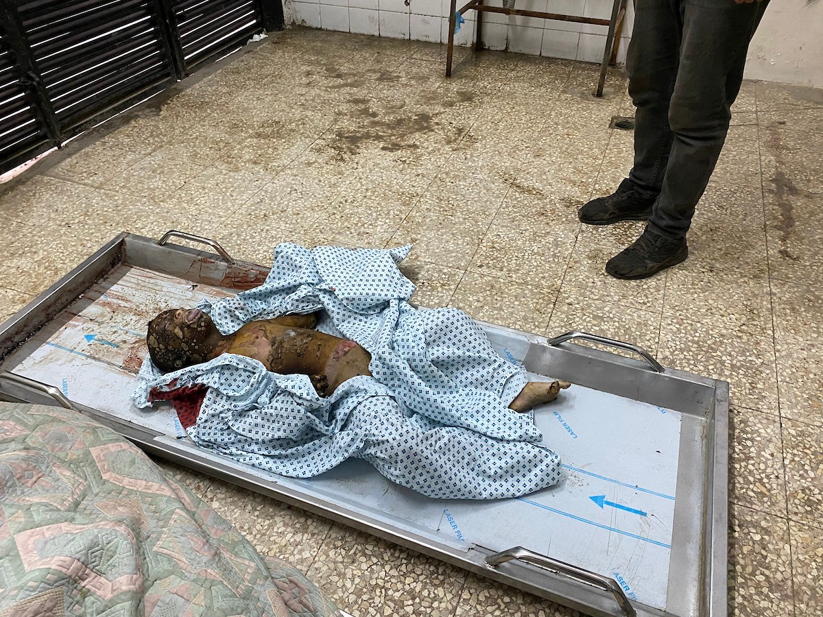 وصل جثمان طفل متوفى إلى مستشفى شهداء الأقصى إثر انفجار جسم مشبوه من مخلفات الاحتلال الإسرائيلي التي خلّفتها الحرب في مخيم النصيرات للاجئين وسط قطاع غزة. ١٨ ديسمبر ٢٠٢٥. تصوير: أحمد إبراهيم