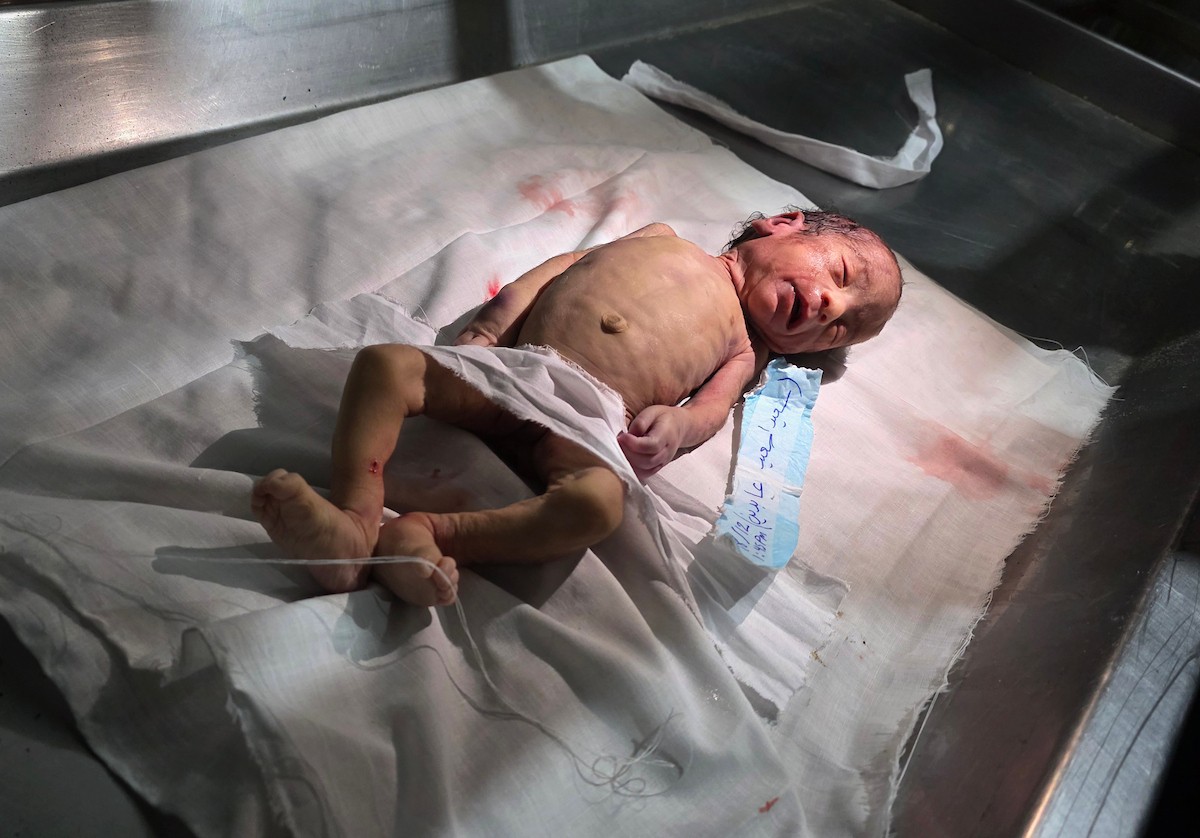 توفي الرضيع الفلسطيني سعيد عابدين، البالغ من العمر شهراً واحداً، نتيجة البرد القارس في خان يونس، جنوب قطاع غزة، ليرتفع بذلك عدد ضحايا العاصفة إلى 13. صور : طارق محمد/ (APA)