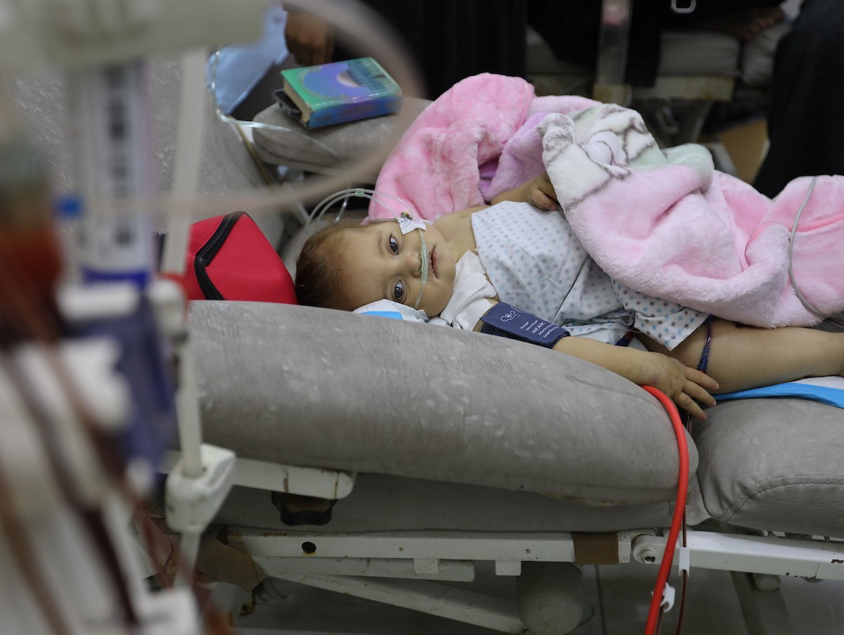 تتلقى الطفلة الفلسطينية سما أبو عجوة، المصابة بمرض نادر، رعاية طبية محدودة في مستشفى الشفاء بمدينة غزة، 19 ديسمبر/كانون الأول 2025. تصوير: عمر أشتوي