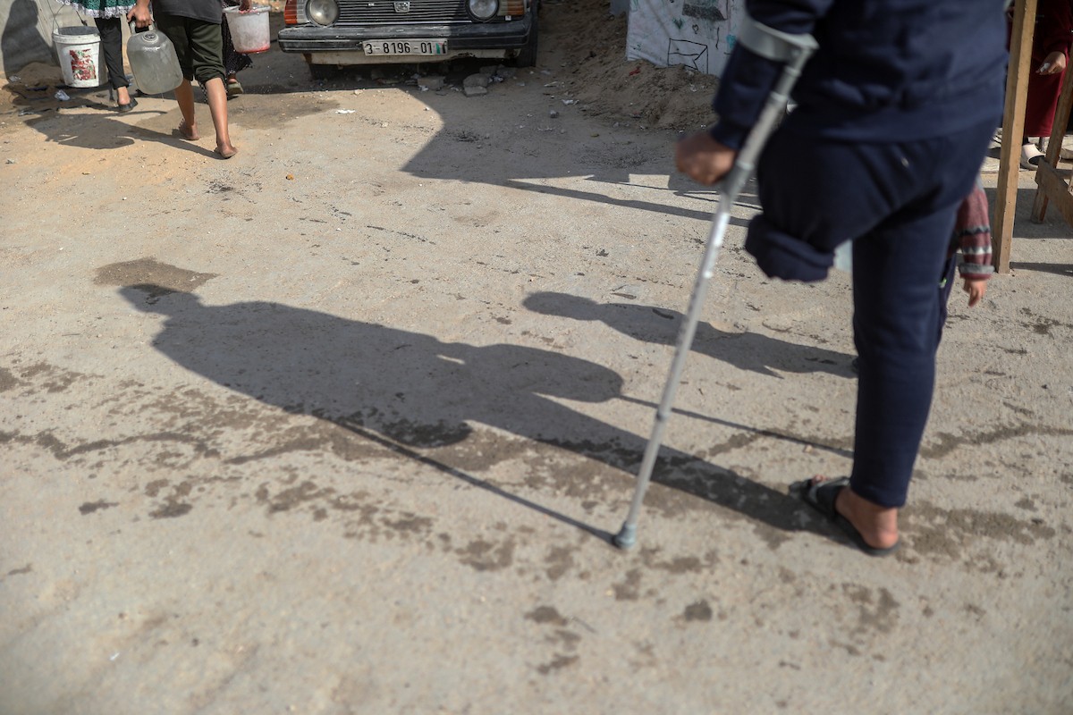 مجدي ريحان، الفلسطيني مبتور الساق، البالغ من العمر 44 عامًا، يعيش مع أطفاله الأربعة في مخيم جباليا شمال غزة بعد استشهاد (16).jpg