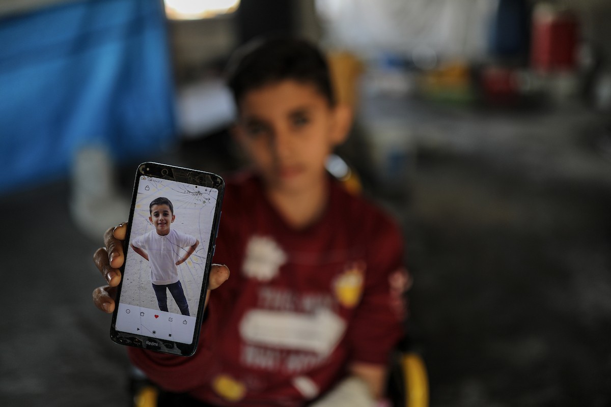 لطفل الفلسطيني محمد المبيض، البالغ من العمر ١٢ عامًا، والذي فقد ساقه في هجوم إسرائيلي على حي الزيتون بغزة (7).jpg