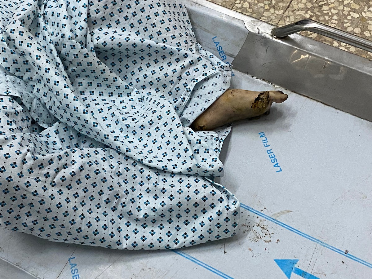 وصل جثمان طفل متوفى إلى مستشفى شهداء الأقصى إثر انفجار جسم مشبوه من مخلفات الاحتلال الإسرائيلي التي خلّفتها الحرب في مخيم النصيرات للاجئين وسط قطاع غزة. ١٨ ديسمبر ٢٠٢٥. تصوير: أحمد إبراهيم