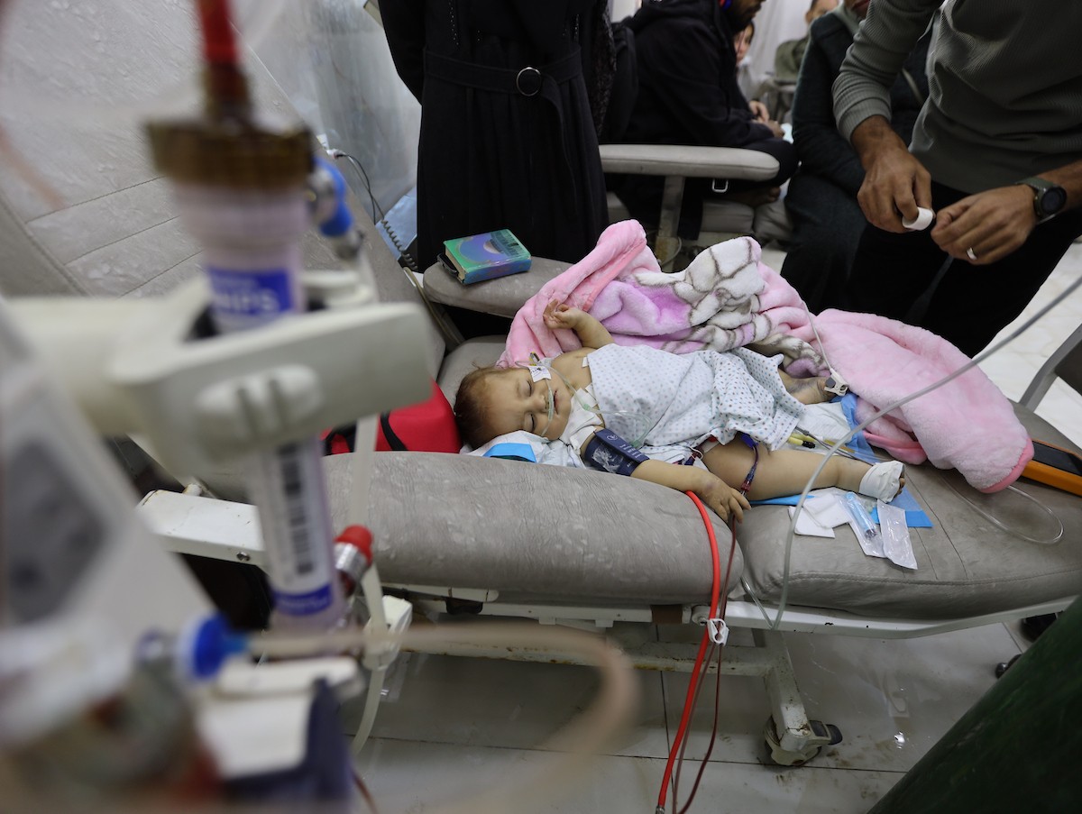 تتلقى الطفلة الفلسطينية سما أبو عجوة، المصابة بمرض نادر، رعاية طبية محدودة في مستشفى الشفاء بمدينة غزة، 19 ديسمبر/كانون الأول 2025. تصوير: عمر أشتوي