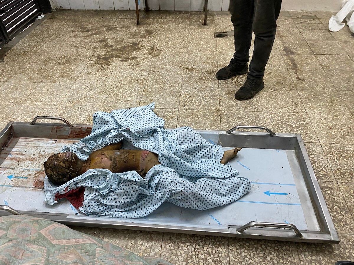 وصل جثمان طفل متوفى إلى مستشفى شهداء الأقصى إثر انفجار جسم مشبوه من مخلفات الاحتلال الإسرائيلي التي خلّفتها الحرب في مخيم النصيرات للاجئين وسط قطاع غزة. ١٨ ديسمبر ٢٠٢٥. تصوير: أحمد إبراهيم