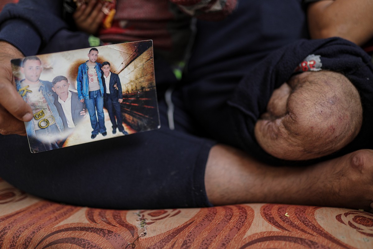 مجدي ريحان، الفلسطيني مبتور الساق، البالغ من العمر 44 عامًا، يعيش مع أطفاله الأربعة في مخيم جباليا شمال غزة بعد استشهاد (12).jpg