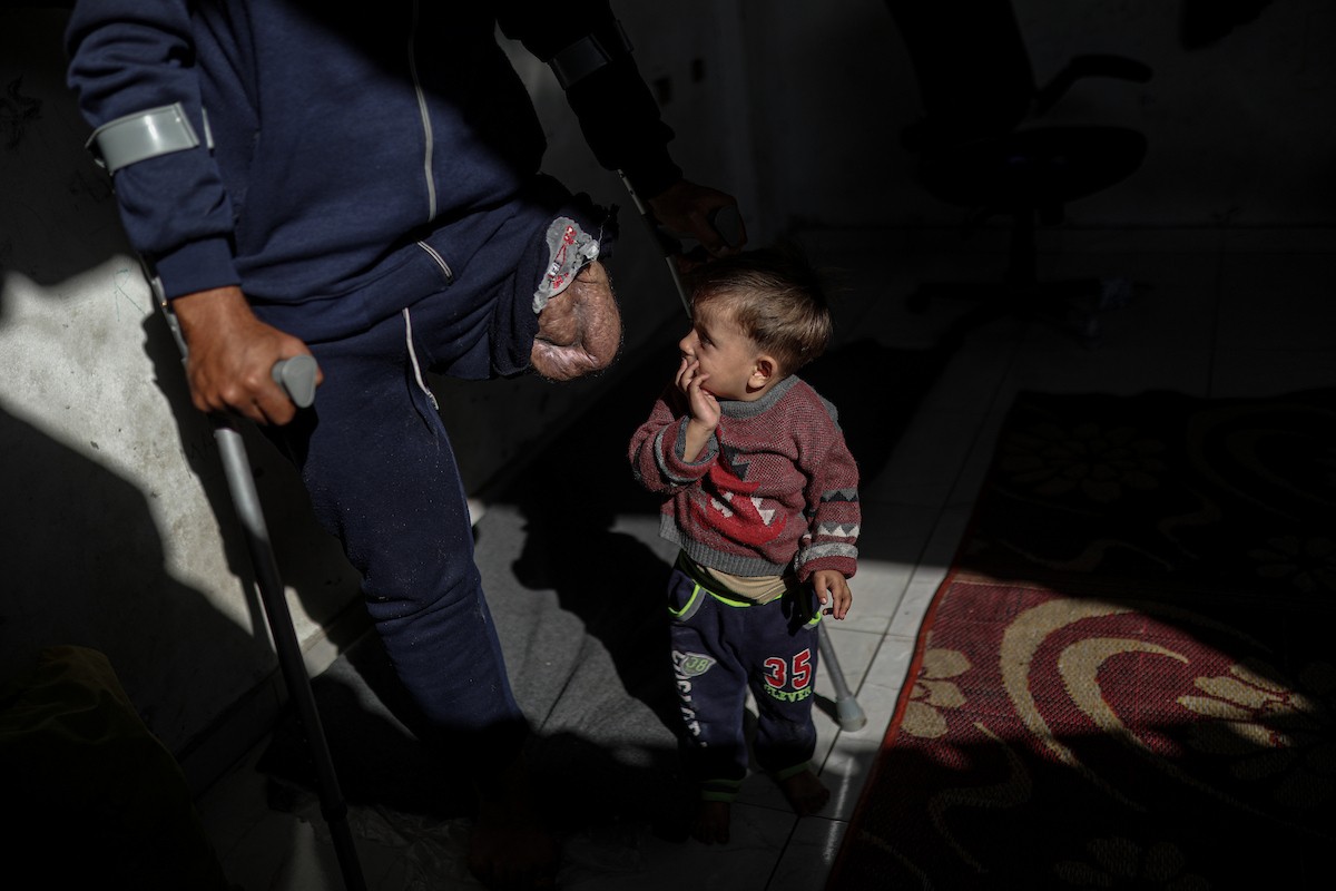 مجدي ريحان، الفلسطيني مبتور الساق، البالغ من العمر 44 عامًا، يعيش مع أطفاله الأربعة في مخيم جباليا شمال غزة بعد استشهاد (5).jpg