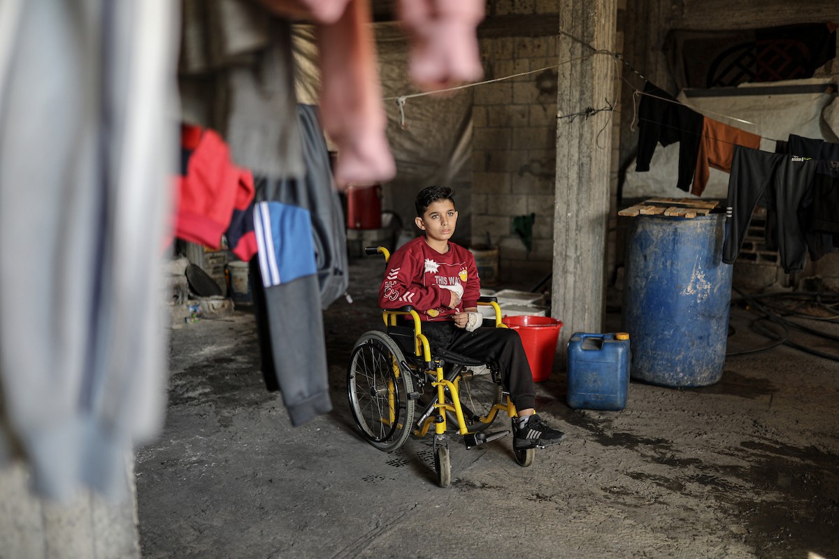 لطفل الفلسطيني محمد المبيض، البالغ من العمر ١٢ عامًا، والذي فقد ساقه في هجوم إسرائيلي على حي الزيتون بغزة (8).jpg