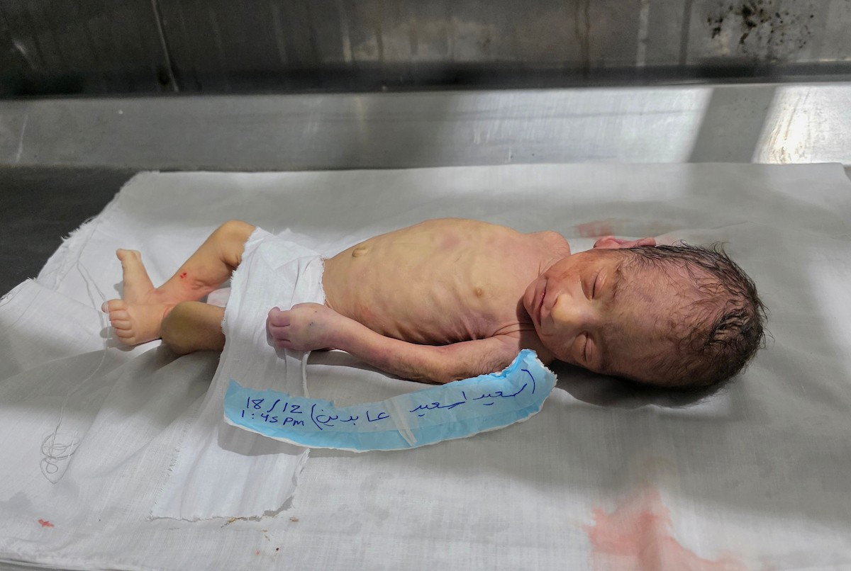 توفي الرضيع الفلسطيني سعيد عابدين، البالغ من العمر شهراً واحداً، نتيجة البرد القارس في خان يونس، جنوب قطاع غزة، ليرتفع بذلك عدد ضحايا العاصفة إلى 13. صور : طارق محمد/ (APA)