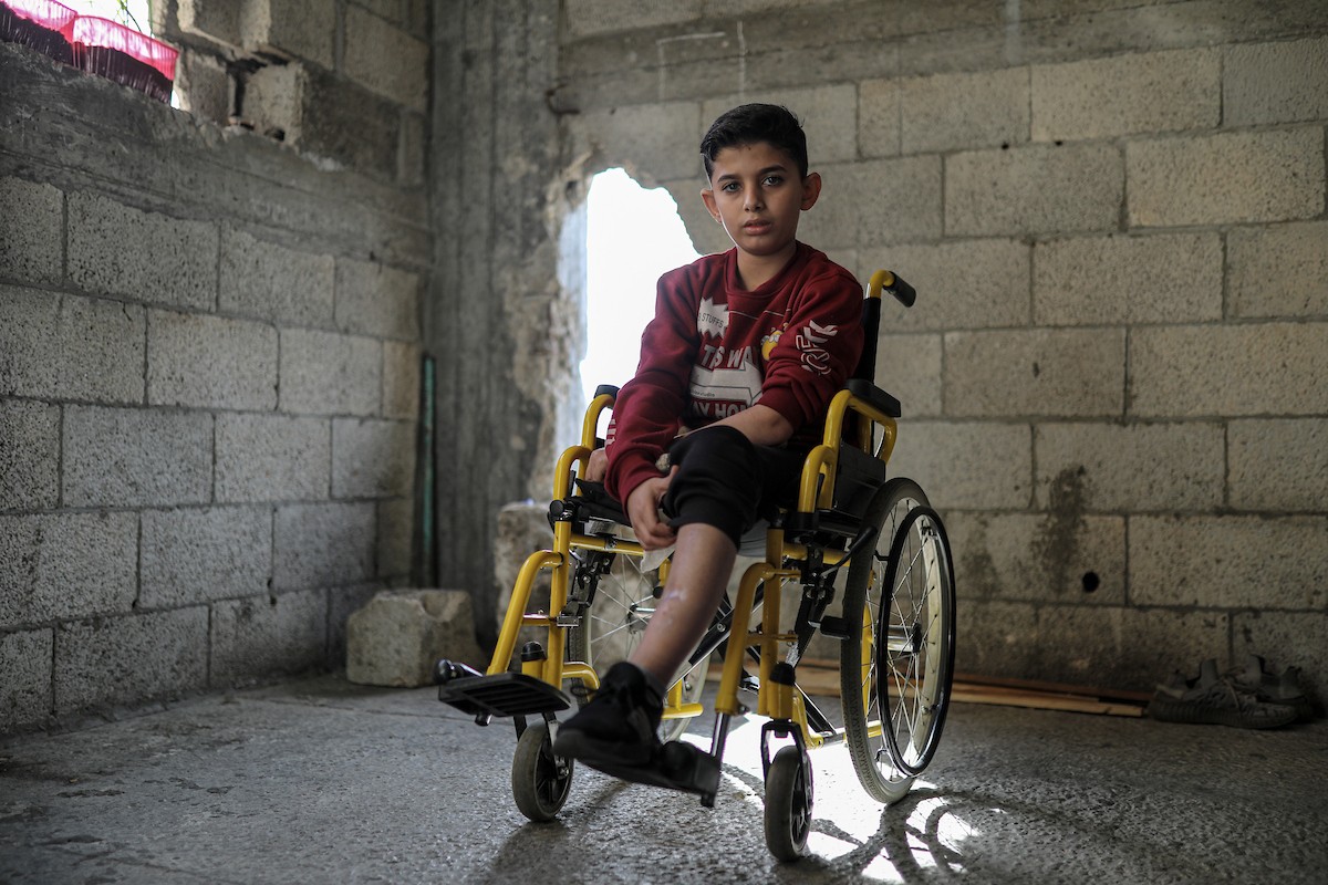 الطفل الفلسطيني محمد المبيض، البالغ من العمر ١٢ عامًا، والذي فقد ساقه في هجوم إسرائيلي على حي الزيتون بغزة (3).jpg