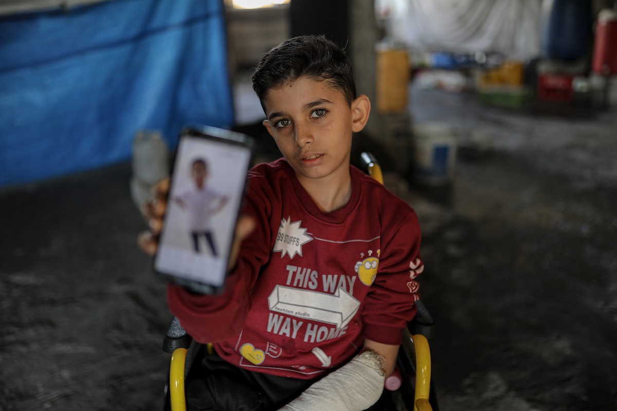 لطفل الفلسطيني محمد المبيض، البالغ من العمر ١٢ عامًا، والذي فقد ساقه في هجوم إسرائيلي على حي الزيتون بغزة (9).jpg