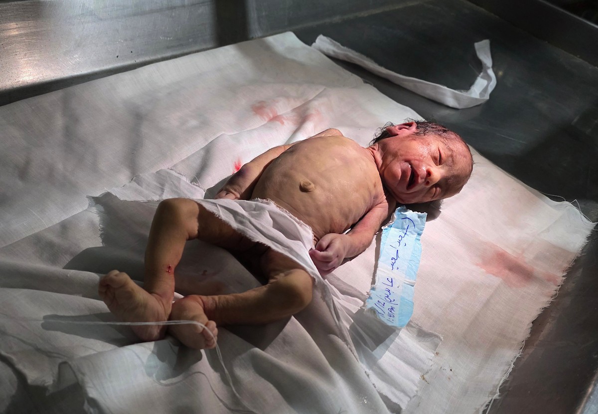 توفي الرضيع الفلسطيني سعيد عابدين، البالغ من العمر شهراً واحداً، نتيجة البرد القارس في خان يونس، جنوب قطاع غزة، ليرتفع بذلك عدد ضحايا العاصفة إلى 13. صور : طارق محمد/ (APA)