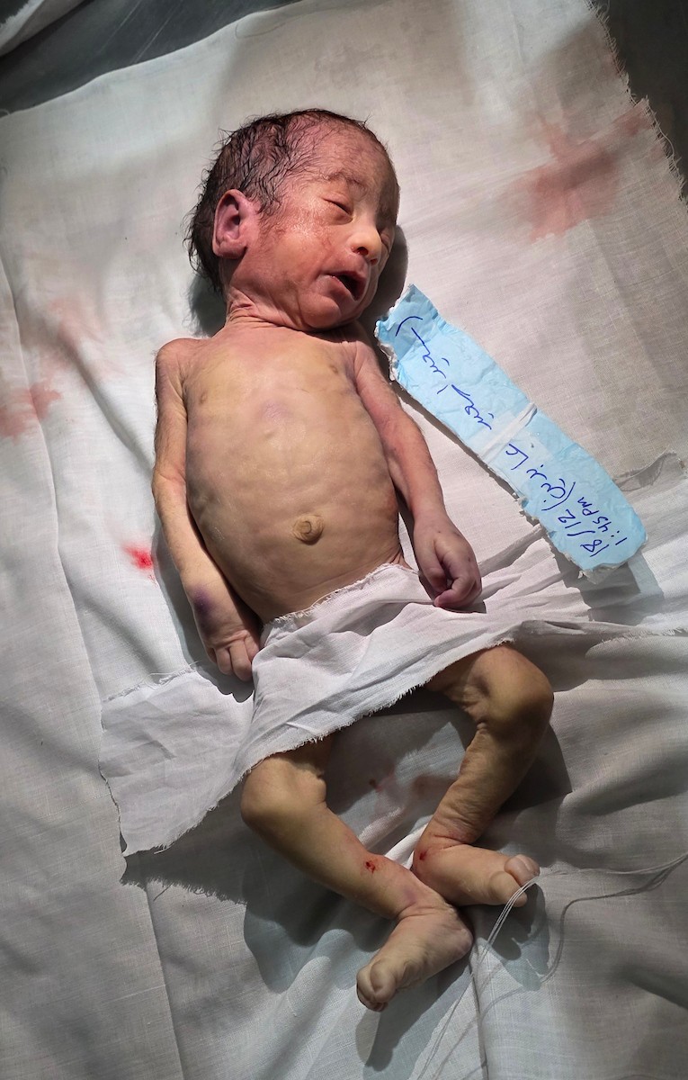 توفي الرضيع الفلسطيني سعيد عابدين، البالغ من العمر شهراً واحداً، نتيجة البرد القارس في خان يونس، جنوب قطاع غزة، ليرتفع بذلك عدد ضحايا العاصفة إلى 13. صور : طارق محمد/ (APA)