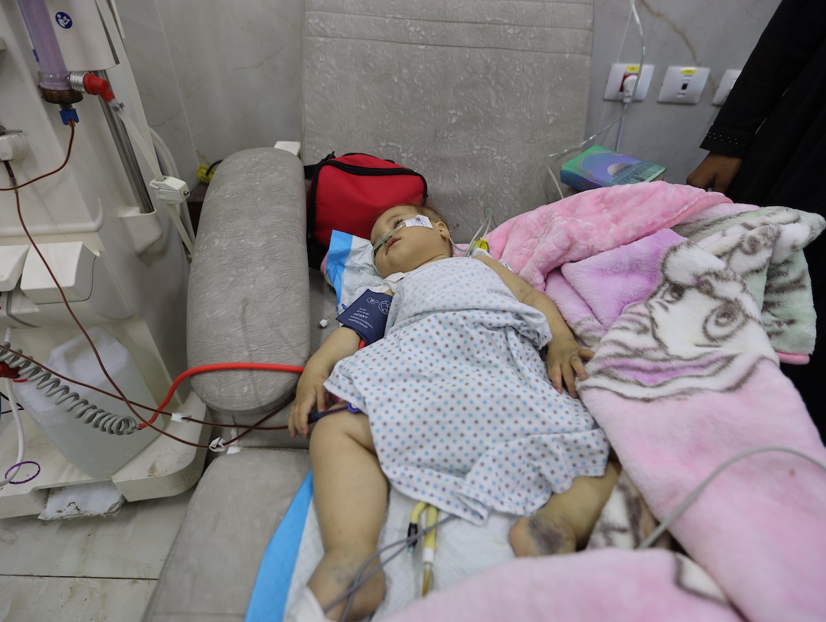 تتلقى الطفلة الفلسطينية سما أبو عجوة، المصابة بمرض نادر، رعاية طبية محدودة في مستشفى الشفاء بمدينة غزة، 19 ديسمبر/كانون الأول 2025. تصوير: عمر أشتوي
