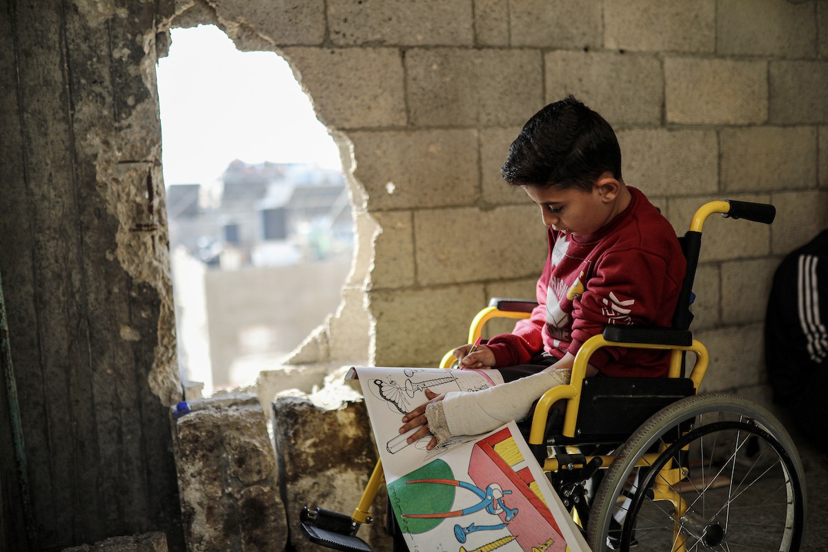 لطفل الفلسطيني محمد المبيض، البالغ من العمر ١٢ عامًا، والذي فقد ساقه في هجوم إسرائيلي على حي الزيتون بغزة.jpg