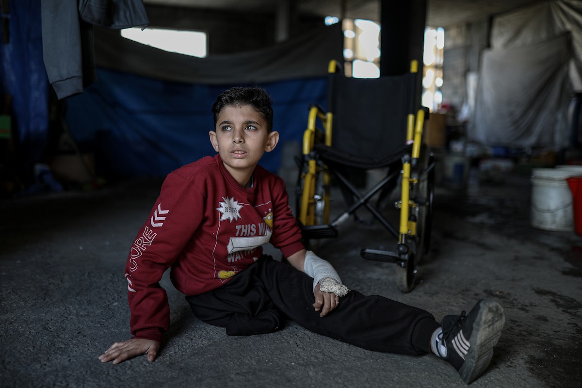 لطفل الفلسطيني محمد المبيض، البالغ من العمر ١٢ عامًا، والذي فقد ساقه في هجوم إسرائيلي على حي الزيتون بغزة (10).jpg