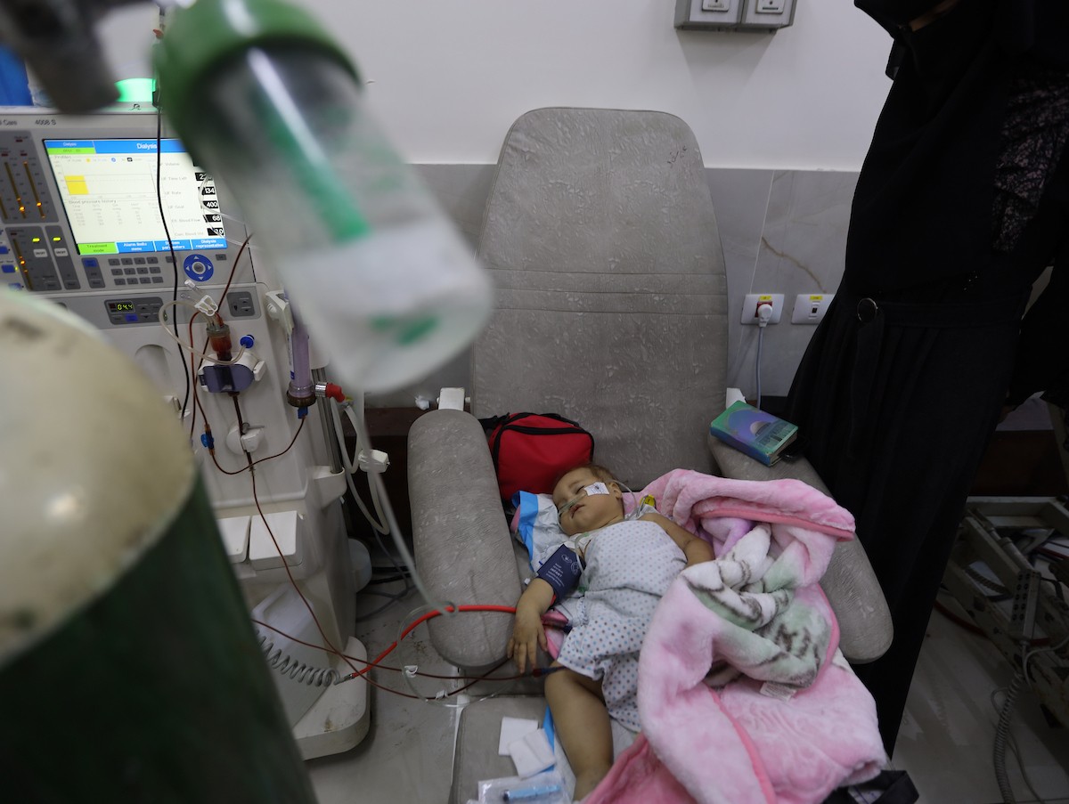 تتلقى الطفلة الفلسطينية سما أبو عجوة، المصابة بمرض نادر، رعاية طبية محدودة في مستشفى الشفاء بمدينة غزة، 19 ديسمبر/كانون الأول 2025. تصوير: عمر أشتوي