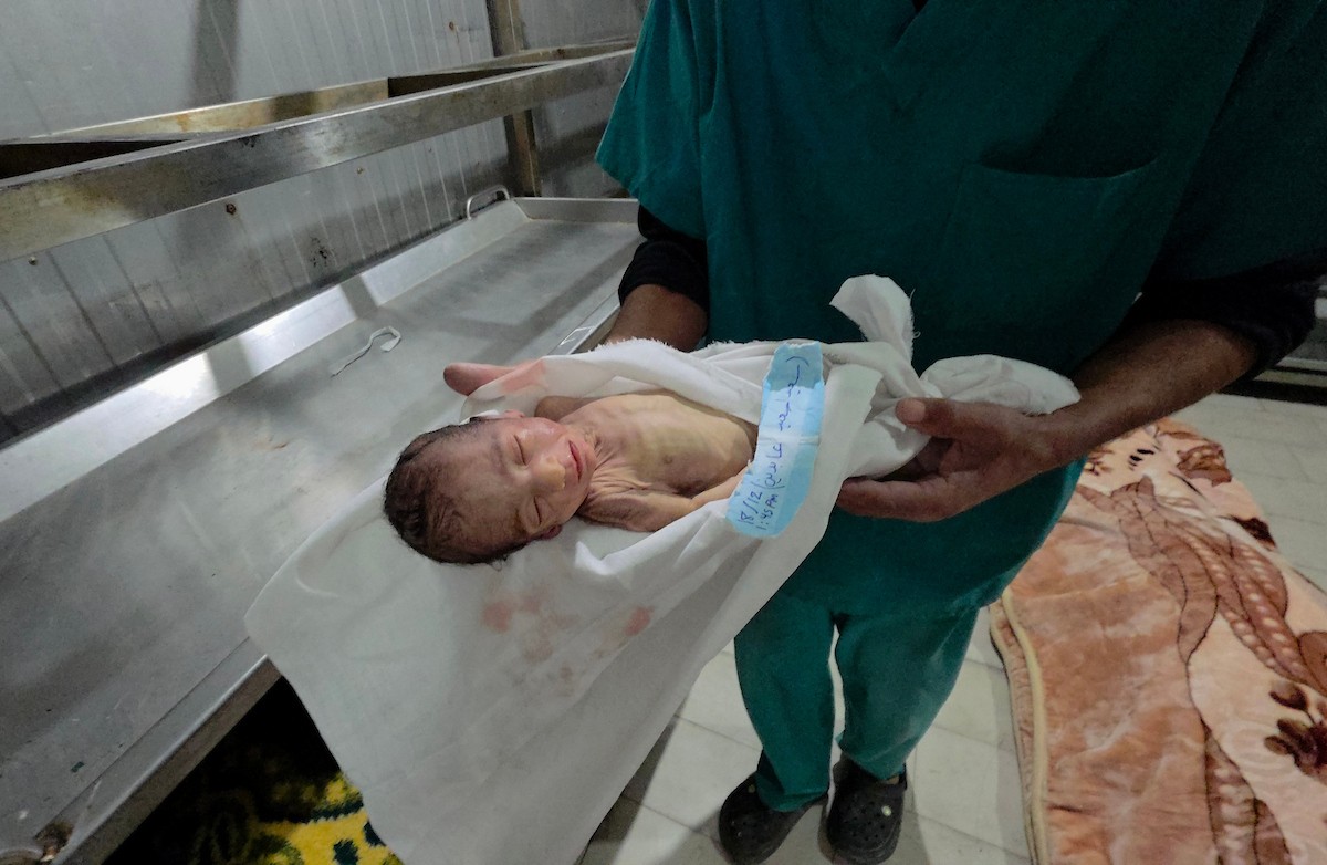 توفي الرضيع الفلسطيني سعيد عابدين، البالغ من العمر شهراً واحداً، نتيجة البرد القارس في خان يونس، جنوب قطاع غزة، ليرتفع بذلك عدد ضحايا العاصفة إلى 13. صور : طارق محمد/ (APA)