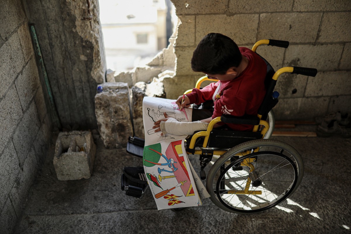 الطفل الفلسطيني محمد المبيض، البالغ من العمر ١٢ عامًا، والذي فقد ساقه في هجوم إسرائيلي على حي الزيتون بغزة (5).jpg