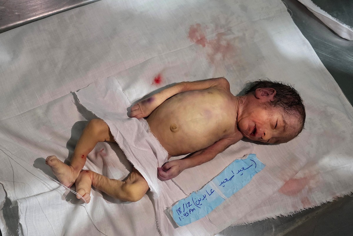 توفي الرضيع الفلسطيني سعيد عابدين، البالغ من العمر شهراً واحداً، نتيجة البرد القارس في خان يونس، جنوب قطاع غزة، ليرتفع بذلك عدد ضحايا العاصفة إلى 13. صور : طارق محمد/ (APA)