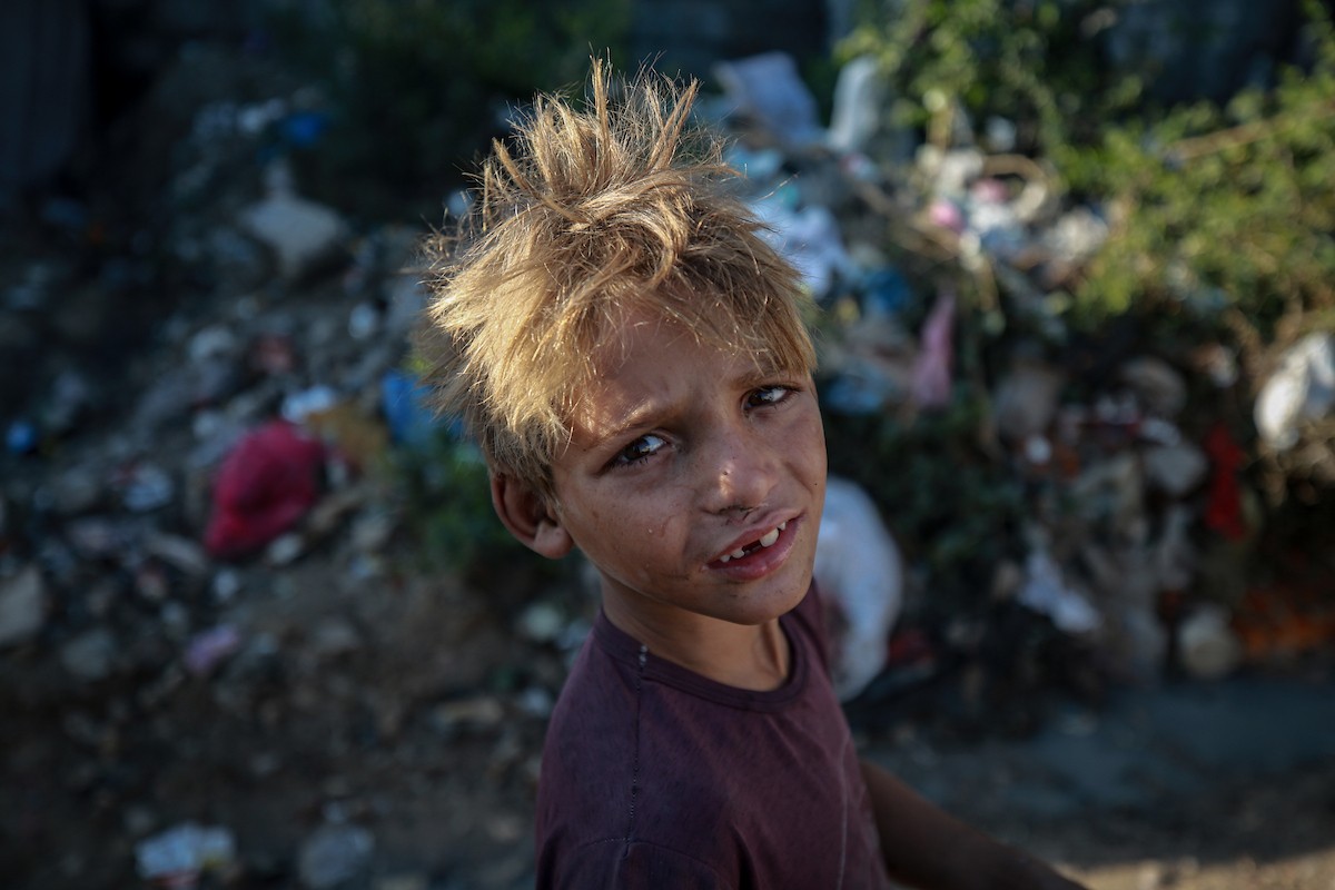 خيام قرب مكب نفايات في حي اليرموك بمدينة غزة،20 ديسمبر/كانون الأول 2025. صورة: عمر أشتوي