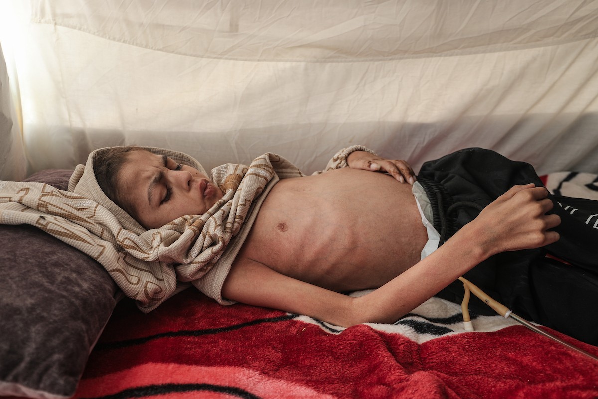 الطفل سيف رامي حجازي (13 عاما) أُصيب بشلل كامل وفشل كلوي إثر قصف إسرائيلي لخيمة عائلته، وتتولى والدته رعايته في ظروف إنسانية بالغة الصعوبة بمخيم المغازي، وسط قطاع غزة، 30 يناير/كانون الثاني 2026. صورة: معز صالحي