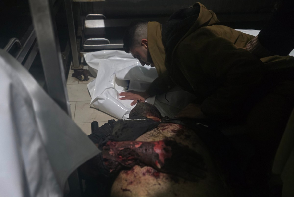 وصلت جثة مواطن وعدة مصابين إلى مجمع ناصر الطبي عقب هجوم إسرائيلي على خيمة تأوي نازحين في منطقة العطار (المواصي) بخان يونس، جنوب قطاع غزة، في 8 يناير/كانون الثاني 2026. (صورة: طارق محمد)