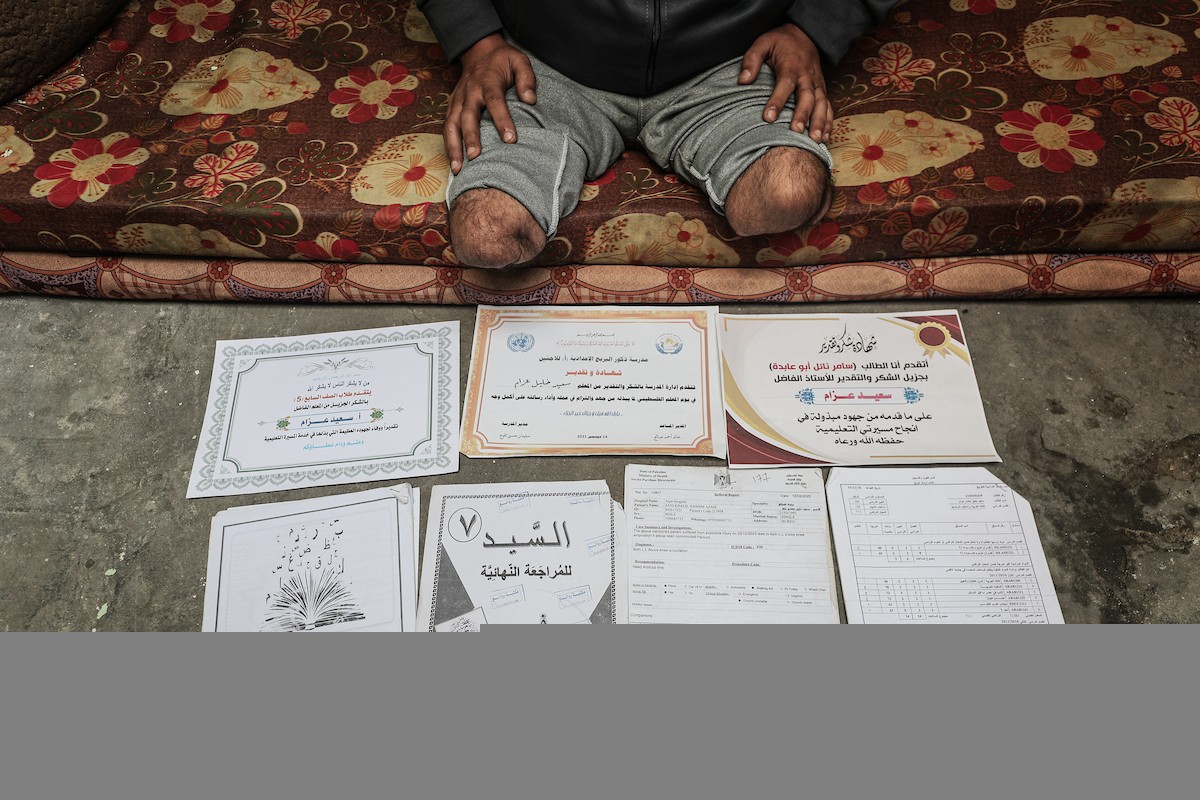  المعلّم سعيد خليل عزم (33 عامًا) أُصيب بجروح بالغة أدّت إلى بتر قدميه، جراء قصف إسرائيلي خلال الحرب على غزة، في مخيم البريج وسط القطاع،  يناير/كانون الثاني 2026. تصوير: معز صالحي