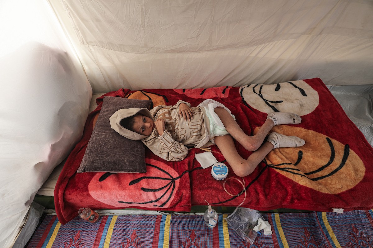 الطفل سيف رامي حجازي (13 عاما) أُصيب بشلل كامل وفشل كلوي إثر قصف إسرائيلي لخيمة عائلته، وتتولى والدته رعايته في ظروف إنسانية بالغة الصعوبة بمخيم المغازي، وسط قطاع غزة، 30 يناير/كانون الثاني 2026. صورة: معز صالحي