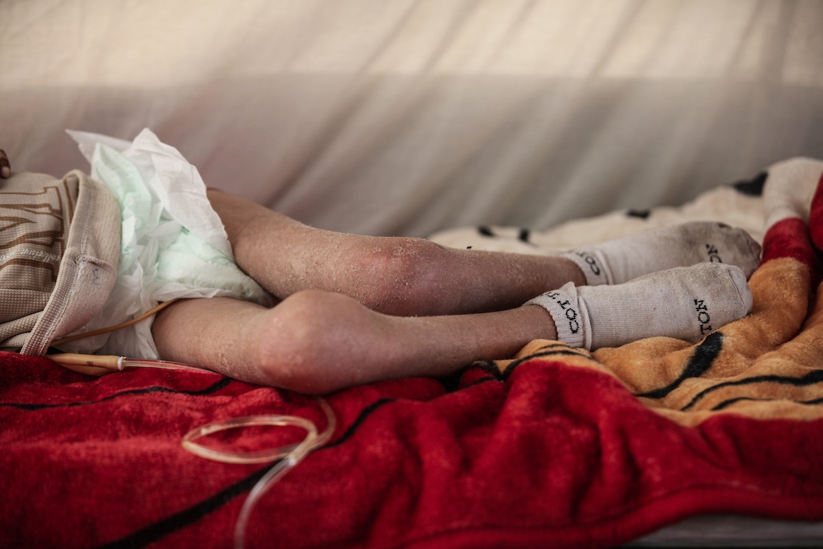 الطفل سيف رامي حجازي (13 عاما) أُصيب بشلل كامل وفشل كلوي إثر قصف إسرائيلي لخيمة عائلته، وتتولى والدته رعايته في ظروف إنسانية بالغة الصعوبة بمخيم المغازي، وسط قطاع غزة، 30 يناير/كانون الثاني 2026. صورة: معز صالحي