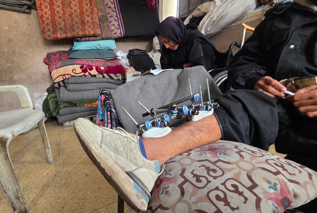 ريماس أبو لحية ووالدها مصابان بساقيهما برصاص الجيش الإسرائيلي، وينتظران السفر لاستكمال العلاج خارج قطاع غزة، خان يونس، 25 يناير/كانون الثاني 2026. تصوير: طارق محمد/ (APA Images)