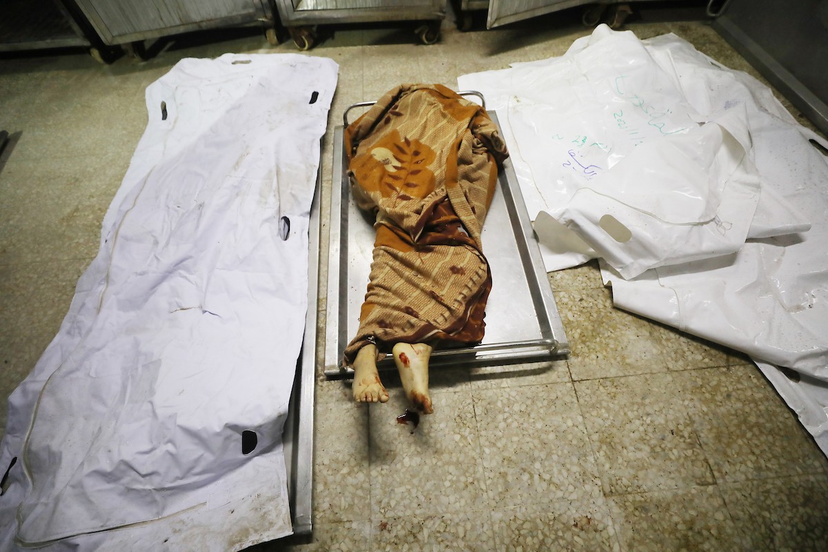 تُنقل جثث الضحايا إلى مستشفى الشفاء بعد هجوم إسرائيلي على مركز شرطة الشيخ رضوان، رغم وقف إطلاق النار في مدينة غزة، بتاريخ 31 يناير/كانون الثاني 2026. وألحق الهجوم على حي الشيخ رضوان غرب مدينة غزة أضرارًا جسيمة بالمباني والمركبات المجاورة. (صورة: عمر أشتوي)