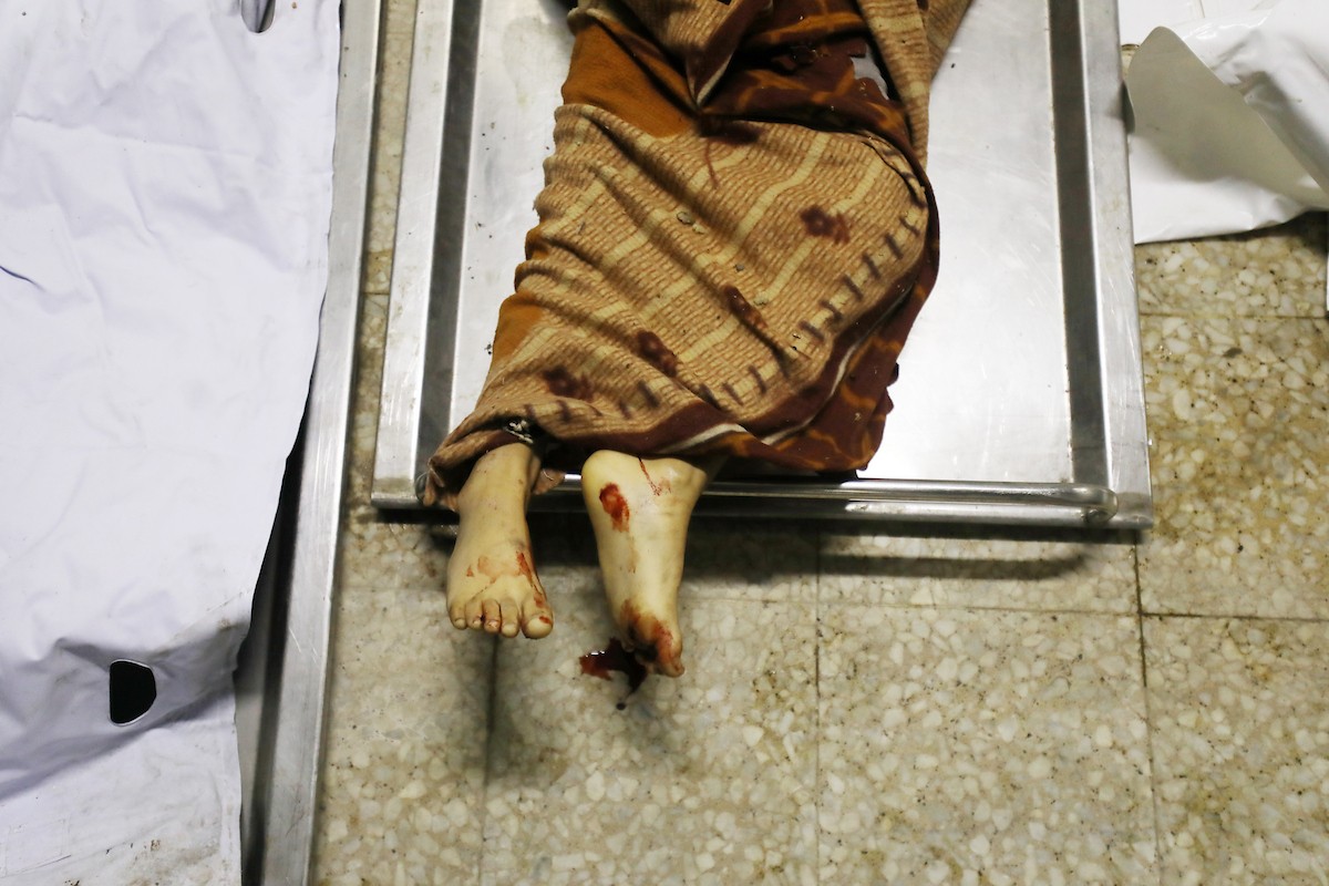 تُنقل جثث الضحايا إلى مستشفى الشفاء بعد هجوم إسرائيلي على مركز شرطة الشيخ رضوان، رغم وقف إطلاق النار في مدينة غزة، بتاريخ 31 يناير/كانون الثاني 2026. وألحق الهجوم على حي الشيخ رضوان غرب مدينة غزة أضرارًا جسيمة بالمباني والمركبات المجاورة. (صورة: عمر أشتوي)