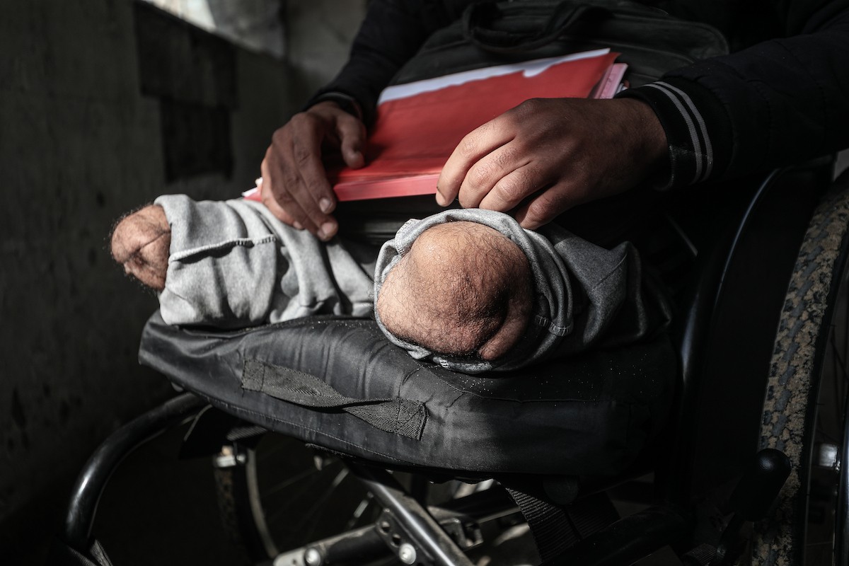  المعلّم سعيد خليل عزم (33 عامًا) أُصيب بجروح بالغة أدّت إلى بتر قدميه، جراء قصف إسرائيلي خلال الحرب على غزة، في مخيم البريج وسط القطاع،  يناير/كانون الثاني 2026. تصوير: معز صالحي