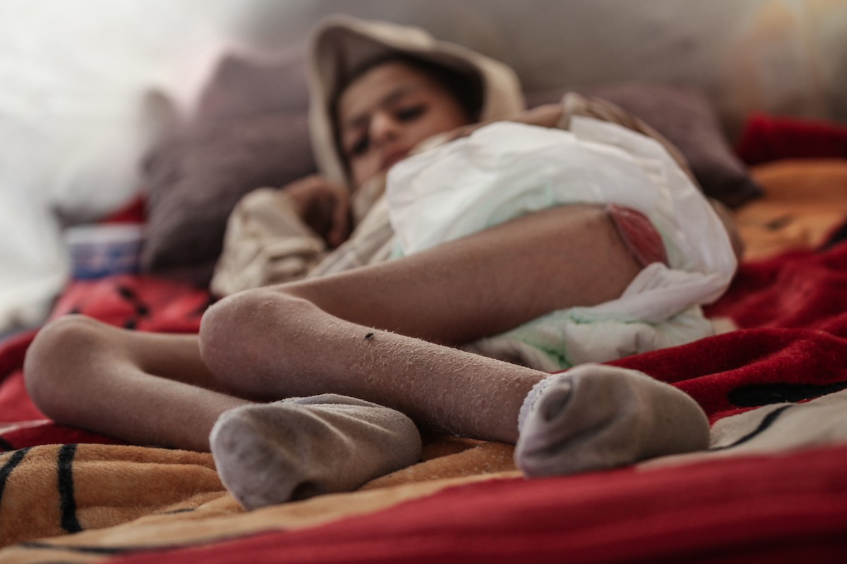 الطفل سيف رامي حجازي (13 عاما) أُصيب بشلل كامل وفشل كلوي إثر قصف إسرائيلي لخيمة عائلته، وتتولى والدته رعايته في ظروف إنسانية بالغة الصعوبة بمخيم المغازي، وسط قطاع غزة، 30 يناير/كانون الثاني 2026. صورة: معز صالحي