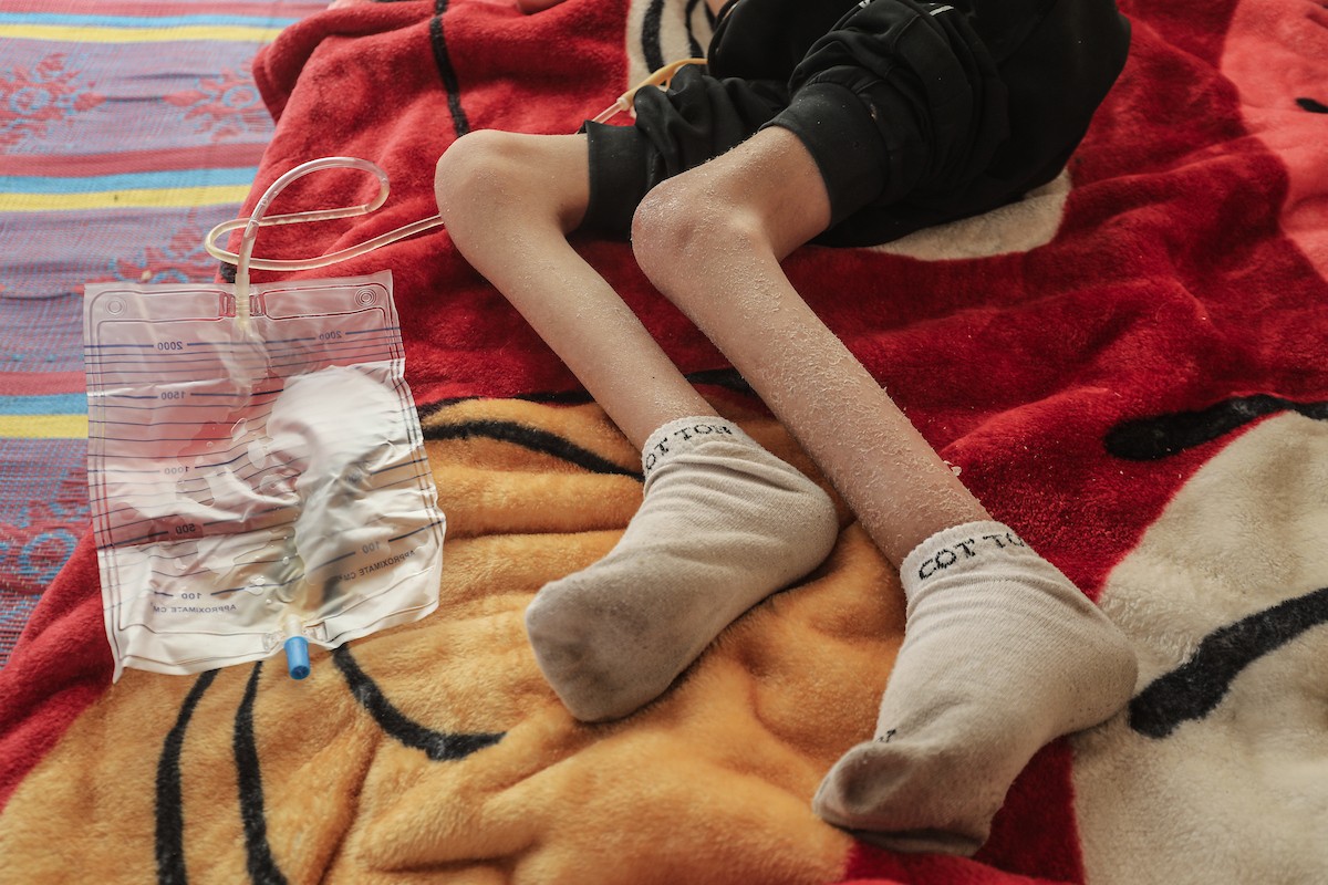 الطفل سيف رامي حجازي (13 عاما) أُصيب بشلل كامل وفشل كلوي إثر قصف إسرائيلي لخيمة عائلته، وتتولى والدته رعايته في ظروف إنسانية بالغة الصعوبة بمخيم المغازي، وسط قطاع غزة، 30 يناير/كانون الثاني 2026. صورة: معز صالحي