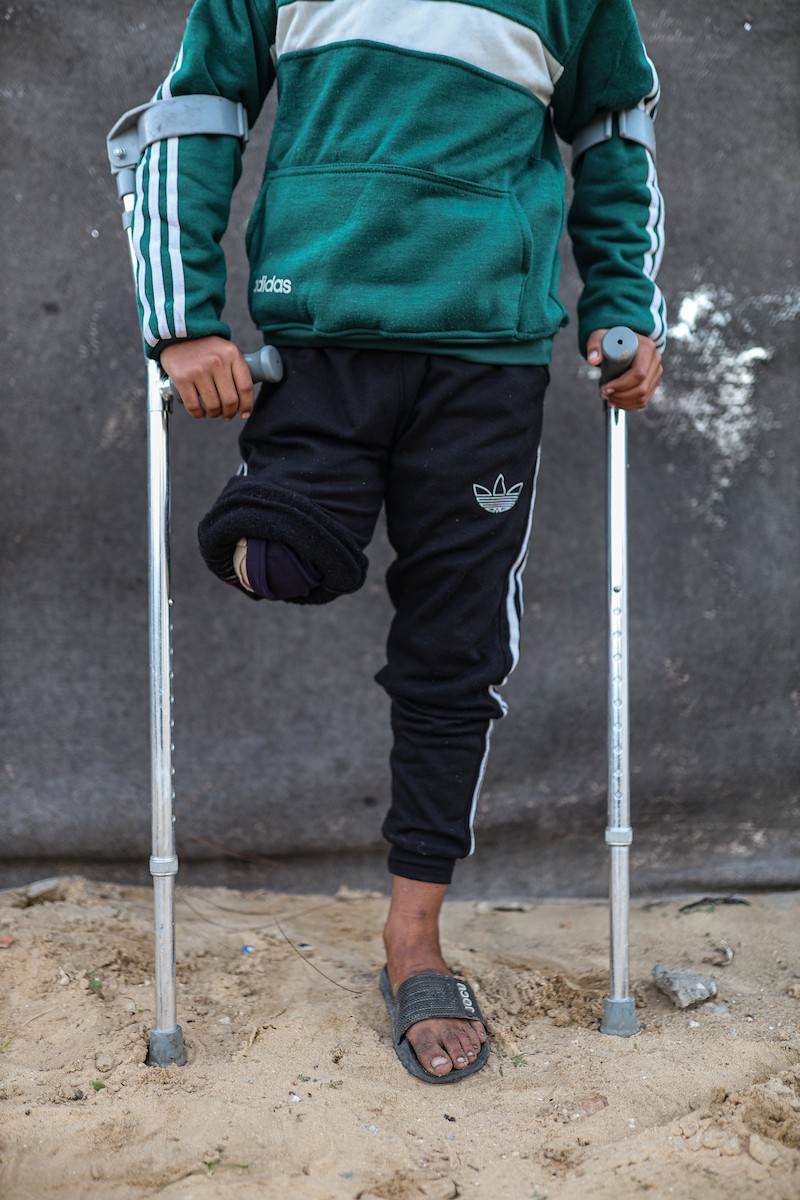 الطفل عمر حلاوة (13عاما) يزور مكان دفن ساقه المبتور يوميا، بعد إصابته في غارة إسرائيلية خلال الحرب على غزة، 31 ديسمبر/كانون الأول 2025. تصوير: عمر أشتوي