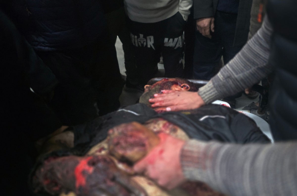 وصلت جثة مواطن وعدة مصابين إلى مجمع ناصر الطبي عقب هجوم إسرائيلي على خيمة تأوي نازحين في منطقة العطار (المواصي) بخان يونس، جنوب قطاع غزة، في 8 يناير/كانون الثاني 2026. (صورة: طارق محمد)